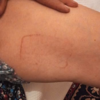 Doctorem Alerji Yaptı İade Kabul Etmiyor