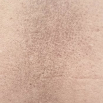 Doctorem Alerji Yaptı İade Kabul Etmiyor