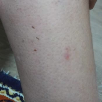 Doctorem Alerji Yaptı İade Kabul Etmiyor