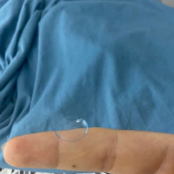 Acuvue Oasys Kontak Lens Yırtık Çıkma Sorunu