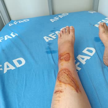 Sağlık Bakanlığı İnsan Hayatını Hiçe Sayma