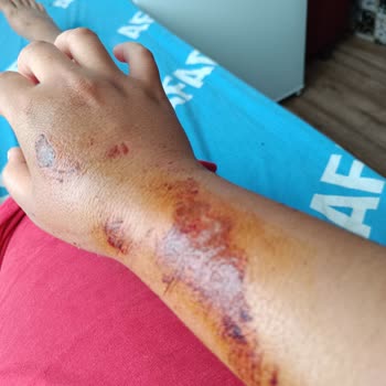 Sağlık Bakanlığı İnsan Hayatını Hiçe Sayma