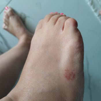 Tommy Hilfiger Tommy Jeans Terliklerim Ayağımı Deldi