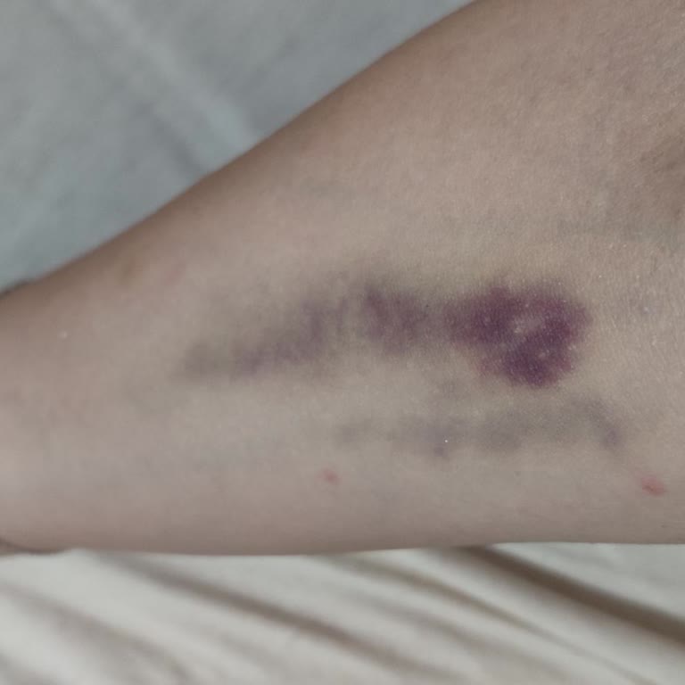 Gaziosmanpaşa Eğitim ve Araştırma Hastanesi Gaziosmanpaşa Hastanesi'nde Hemşirelerin Dikkatsizliği Ve Saygısızlığı