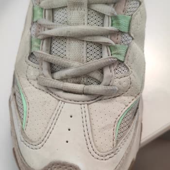 Skechers Ayakkabı Ve Markanın Kalitesizliği