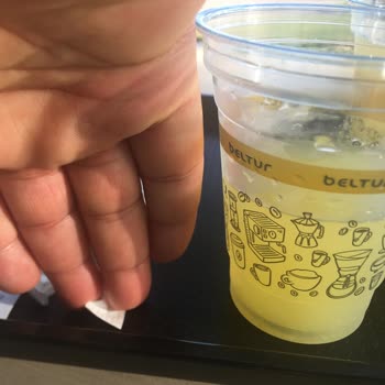 Standart Yok Mu Beltur