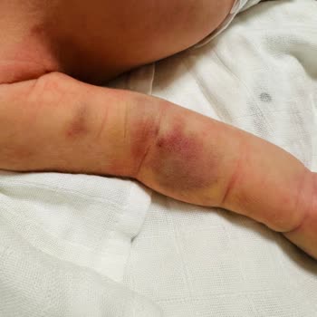 Kızılay Sağlık Grubu Şikayetçiyim