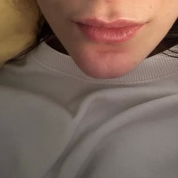 Alisa Clinic Alissa Dolgu+botox Kalıcılığı