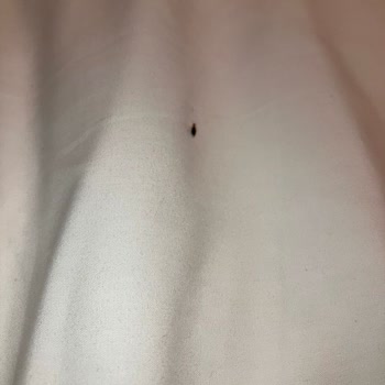 İbis Hotels'te Tahtakurusu Sorunu!