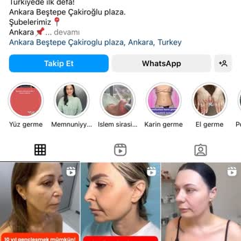 Lydia Yapılan İşlem Farklı Söylenilen Çok Farklı