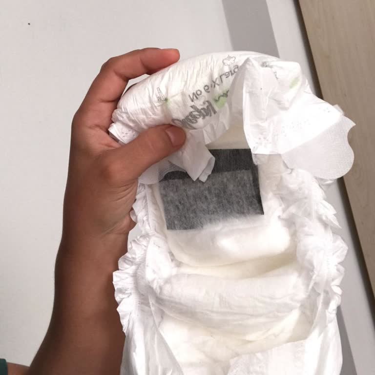 Sleepy Bebek Bezinde Siyah Bir Şey Var