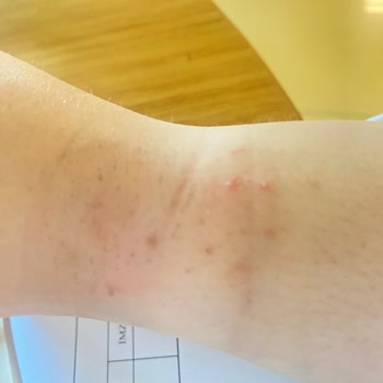 Apple Watch Se Deformasyon Problemi