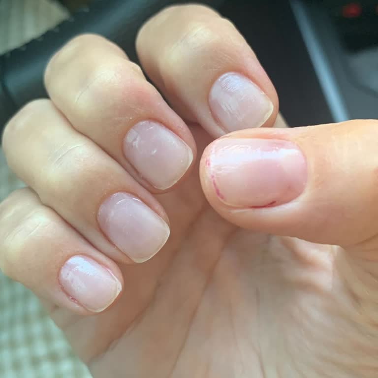 Pelin Öztürk Beauty Center İzmir Memnuniyetsizliği