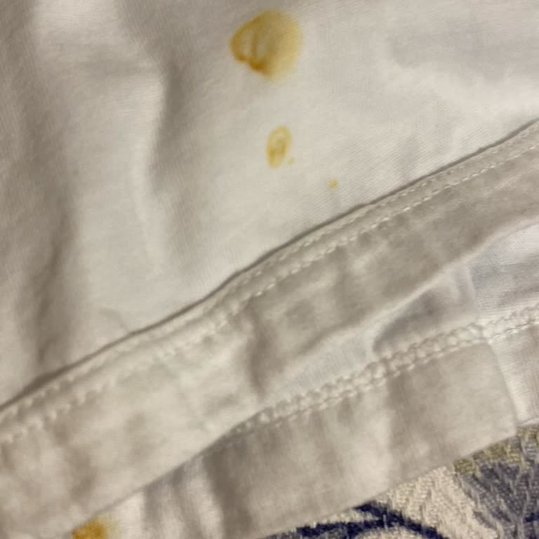 Miele Kalitesi Görselden Gözüküyor!