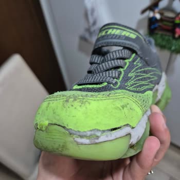 Skechers Marka Ayakkabının 2 Ay İçinde Yırtılması