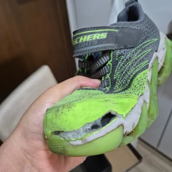Skechers Marka Ayakkabının 2 Ay İçinde Yırtılması