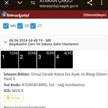 Başakşehir Çam ve Sakura Şehir Hastanesi Rapor Sonuçlarının Gecikmesi Ve Hasta Mağduriyeti