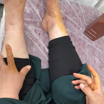 The Marine Hotel Duşakabin Camı Kırılması