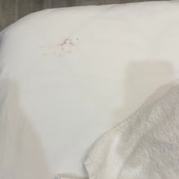 The Marine Hotel Duşakabin Camı Kırılması