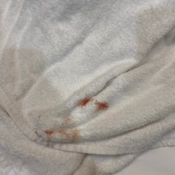 The Marine Hotel Duşakabin Camı Kırılması