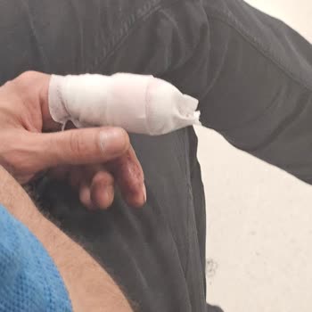 Ankara Bilkent Şehir Hastanesi Acil Serviste Uzun Bekleme Süresi