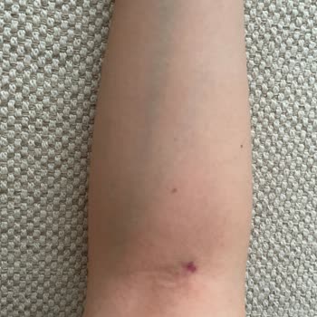 Medipol Sağlık Grubu Bahçelievler Medipol Hastanesinden Şikayetçiyim Laborant Kan Alıyor