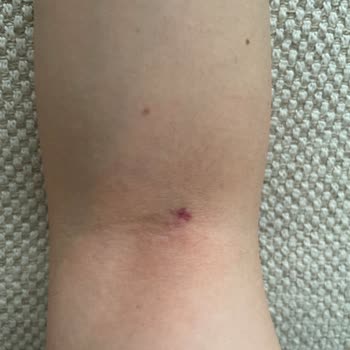 Medipol Sağlık Grubu Bahçelievler Medipol Hastanesinden Şikayetçiyim Laborant Kan Alıyor