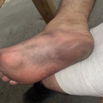 Deichmann 'a Yakışmadı Markasına Yazık