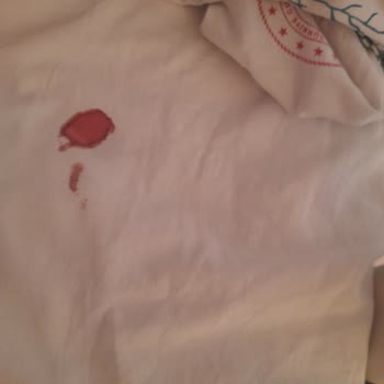 Çorlu Devlet Hastanesi Doğum Servisinde Yaşanan Sorunlar