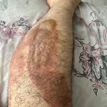 Koru Hastanesi Sincan Özel Koru Ücretsiz Muayene Yapması Gerekirken Haksız Para Alıyor