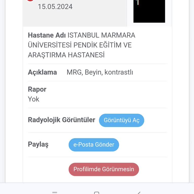 Marmara Üniversitesi Pendik Eğitim ve Araştırma Hastanesi MR Raporlaması Yapılmadı