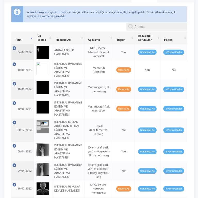 Ankara Bilkent Şehir Hastanesi Neden MR Sonucum Rapor Edilmiyor