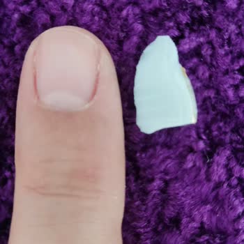 Profilo Yetkili Servis Basit Arızayı Gideremedi.