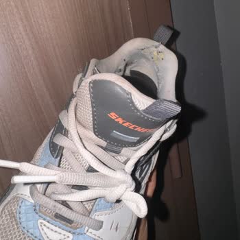 Skechers Kalitesizliği Ve 0 Müşteri Memnuniyeti