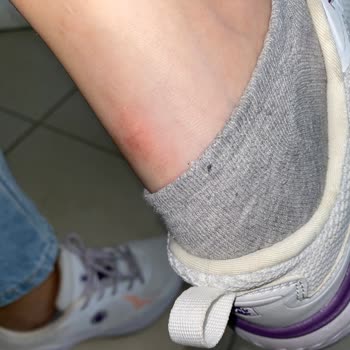 Lumberjack Ayakkabı Ayağımı Mahvetti!