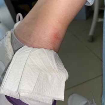 Lumberjack Ayakkabı Ayağımı Mahvetti!