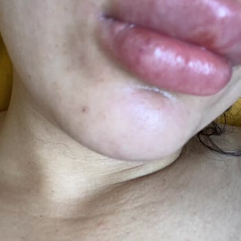 Medica Derma Pendik Şubesinde Yaşanan Tıbbi İşlem Sorunu