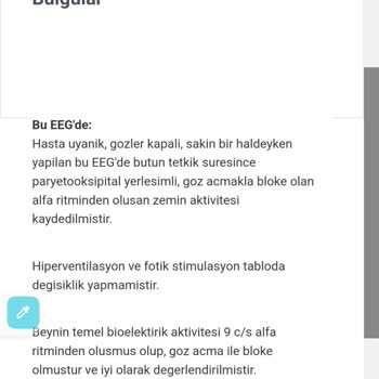 Şişli Hamidiye Etfal Eğitim ve Araştırma Hastanesi EEG Sonuçların İtirazı