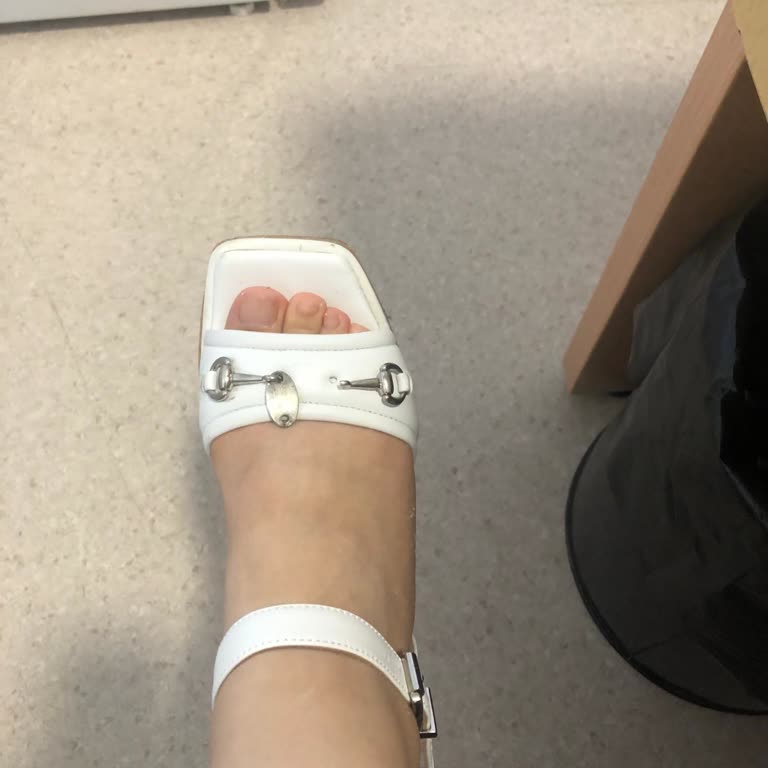 Aldo Shoes Bir Yıldan Az Bir Sürede Deforme Olan Ayakkabı