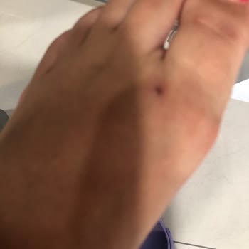 Deichmann Sandaletler Ayaklarımı Mahvetti, İade Kabul Edilmedi!