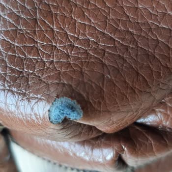 Derimod Çanta Deri Soyuluyor Kalitesiz