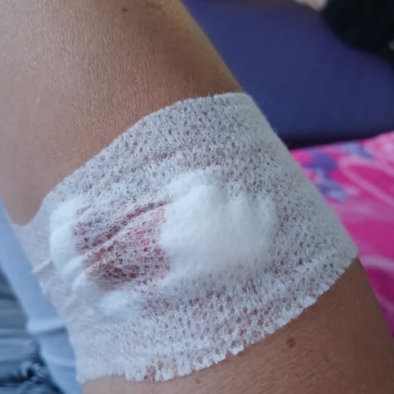 Ankara Eğitim ve Araştırma Hastanesi Ankara Hastanesi Acilinde WC Ye Gitmekte Yasak.