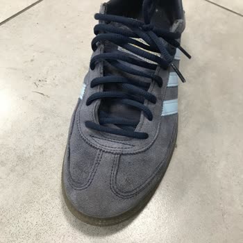 Adidas Gazelle Ayakkabıda Renk Solması Ve İade Sorunu!