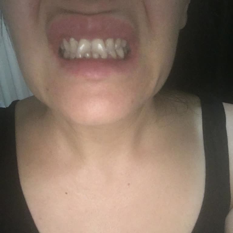 Estrella Medical Group Estrella İzmir Alsancak'taki Güzellik Merkezi Hk