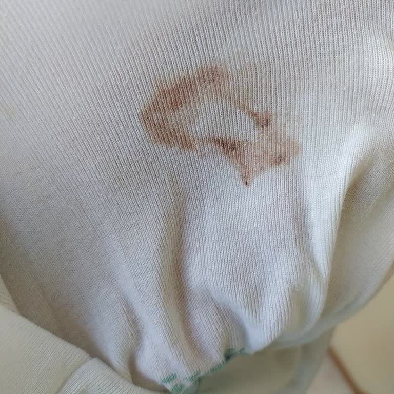 Alo Deterjan Temizlemiyor