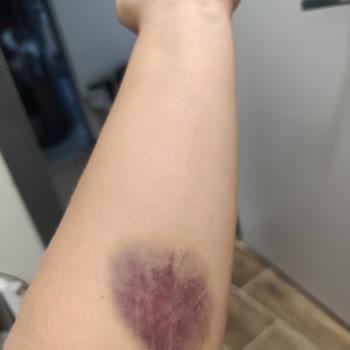 Medicana Bursa Hastanesi Acil Bölümü Devlet Hastanesinden Farksız