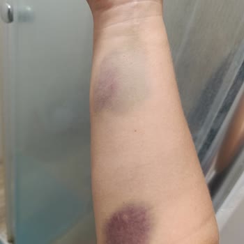 Medicana Bursa Hastanesi Acil Bölümü Devlet Hastanesinden Farksız