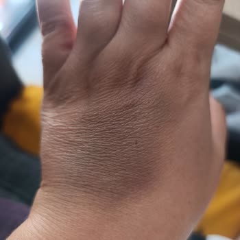 Medicana Bursa Hastanesi Acil Bölümü Devlet Hastanesinden Farksız