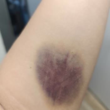 Medicana Bursa Hastanesi Acil Bölümü Devlet Hastanesinden Farksız