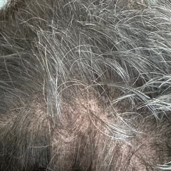 Batçı Hair Atelier Batçı Saç Kapatıcı